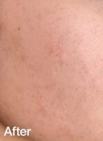 Anua Heartleaf 77% Soothing Toner - 250ml - Image 8