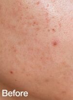 Anua Heartleaf 77% Soothing Toner - 250ml - Image 7