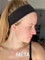 Bee Factor Κεραλοιφή για Ακμή & Σπυράκια 30ml - Image 8