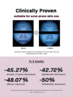 Cosrx The Niacinamide 15 Serum with 15% Niacinamide - 20ml - Image 8