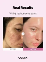 Cosrx The Niacinamide 15 Serum with 15% Niacinamide - 20ml - Image 9