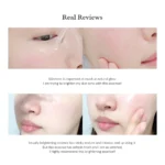 Dr. Althea Natural Radiance Essence- 30ml - Image 5